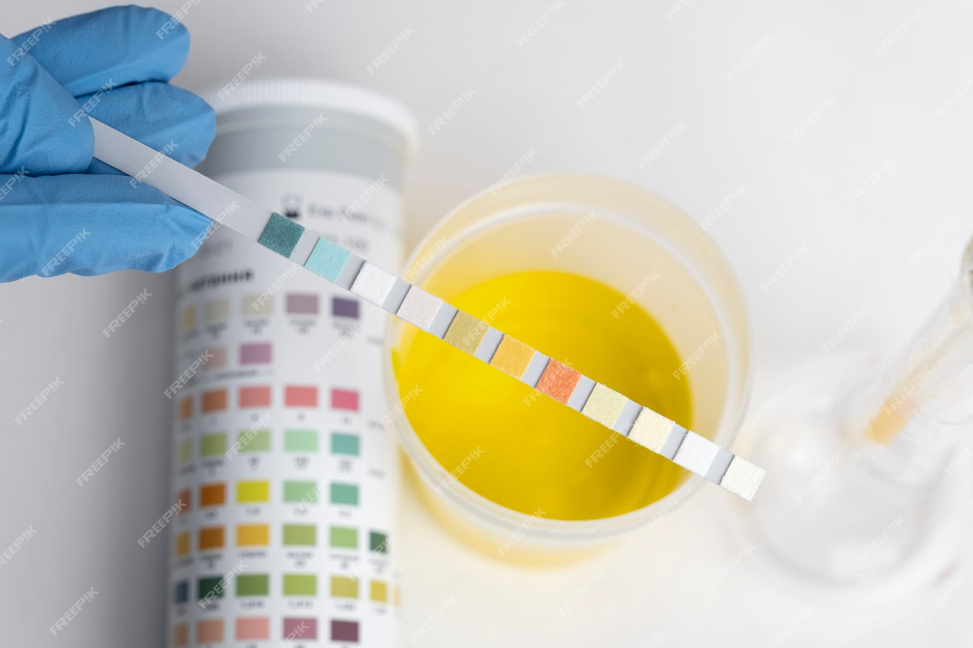 high-ph-in-urine-during-pregnancy-causes-symptoms-and-solutions